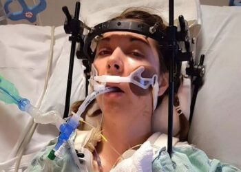 Πώς οι γιατροί ξανακόλλησαν το κεφάλι γυναίκας που είχε υποστεί εσωτερικό αποκεφαλισμό