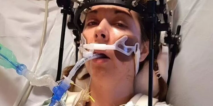 Πώς οι γιατροί ξανακόλλησαν το κεφάλι γυναίκας που είχε υποστεί εσωτερικό αποκεφαλισμό