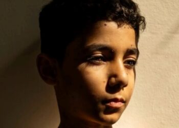 World Press Photo 2025: Η φωτογραφία του 9χρονου ακρωτηριασμένου Παλαιστίνιου που απέσπασε το πρώτο βραβείο