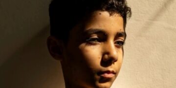 World Press Photo 2025: Η φωτογραφία του 9χρονου ακρωτηριασμένου Παλαιστίνιου που απέσπασε το πρώτο βραβείο