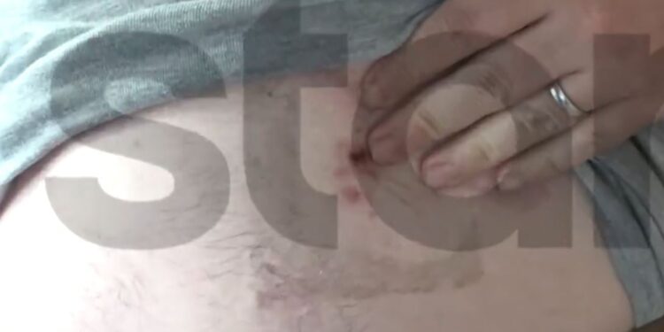 Άλσος Αιγάλεω: Στο νοσοκομείο 28χρονος που έπεσε θύμα ληστείας