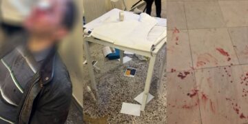 Επίθεση κουκουλοφόρων στη Νομική: Φοιτητές προσπάθησαν να απωθήσουν τους δράστες, στο νοσοκομείο υποψήφιος διδάκτωρ