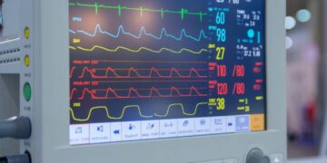Διασωληνωμένος 19χρονος ύστερα από τροχαίο με το μηχανάκι του