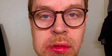 «Θα μπορούσα να είχα πεθάνει» – Το σοβαρό ατύχημα του πρώην τραγουδιστή των Savage Garden