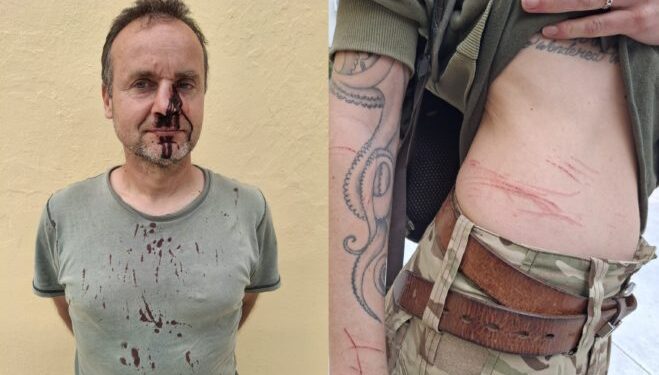 Ζάκυνθος: Άγρια επίθεση από λαθροκυνηγούς καταγγέλλουν ορνιθολόγοι