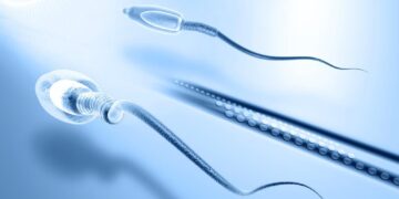 Σπέρμα δότη με σπάνια γενετική μετάλλαξη κατέληξε σε 67 γεννήσεις στην Ευρώπη