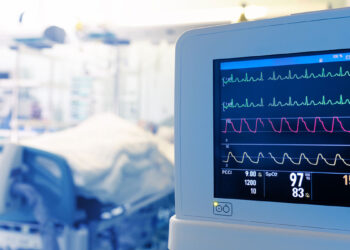 Στη ΜΕΘ Ιωαννίνων μεταφέρεται ο 42χρονος που τραυματίστηκε σε τροχαίο στην Πάτρα – Ώρες αγωνίας για τον πατέρα δύο παιδιών