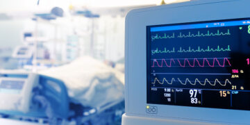 Στη ΜΕΘ Ιωαννίνων μεταφέρεται ο 42χρονος που τραυματίστηκε σε τροχαίο στην Πάτρα – Ώρες αγωνίας για τον πατέρα δύο παιδιών