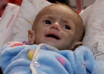 Οι Παλαιστίνιοι αντιμέτωποι με «άμεσο κίνδυνο λιμού»