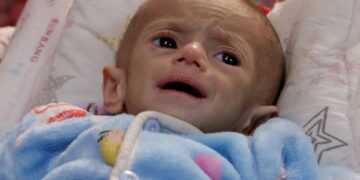 Οι Παλαιστίνιοι αντιμέτωποι με «άμεσο κίνδυνο λιμού»