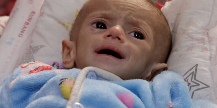 Οι Παλαιστίνιοι αντιμέτωποι με «άμεσο κίνδυνο λιμού»