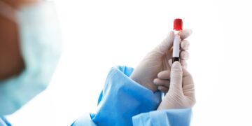 Η ομάδα αίματος που συνδέεται με αυξημένο κίνδυνο, σύμφωνα με μελέτη