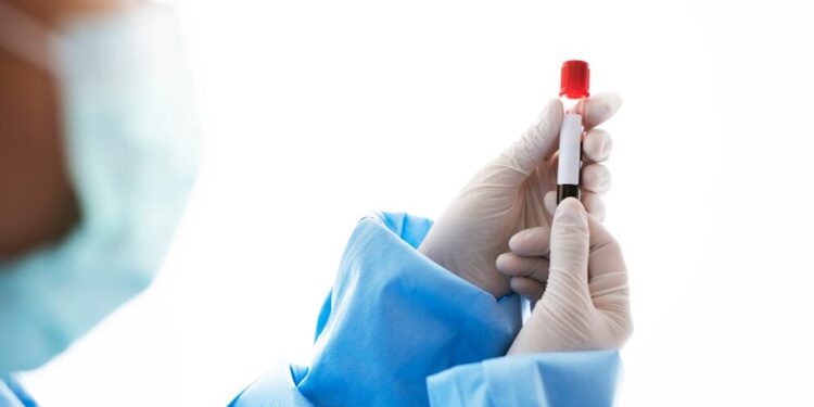 Η ομάδα αίματος που συνδέεται με αυξημένο κίνδυνο, σύμφωνα με μελέτη