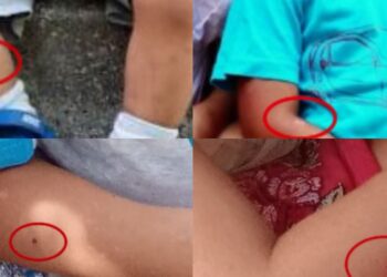 Λάρισα: Η μητέρα είχε χάσει την επιμέλεια του πρώτου παιδιού της