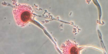 CNN: Scientists express deep concern over deadly fungi that can “eat us from the inside out”