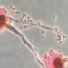 CNN: Scientists express deep concern over deadly fungi that can “eat us from the inside out”