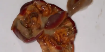 Ανακάλυψε ένα μυστηριώδες αηδιαστικό πράγμα στον χυμό της