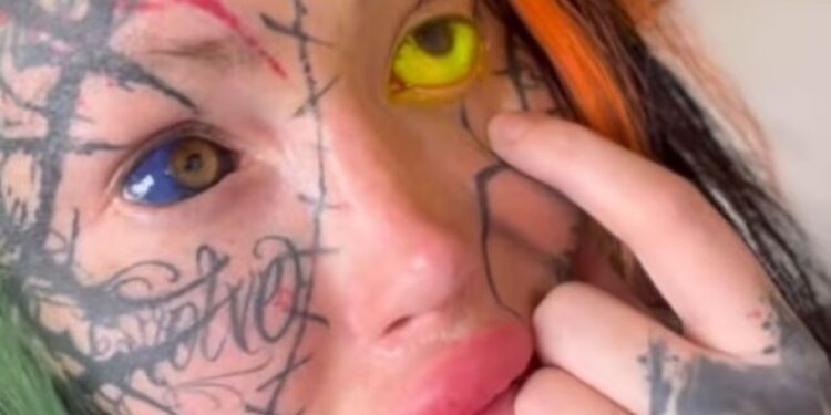 Κινδύνεψε να χάσει το μάτι της έπειτα από αποτυχημένο τατουάζ στο μάτι