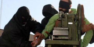 Ακρωτηριασμός χεριού σε δύο άνδρες που είχαν καταδικαστεί για κλοπές