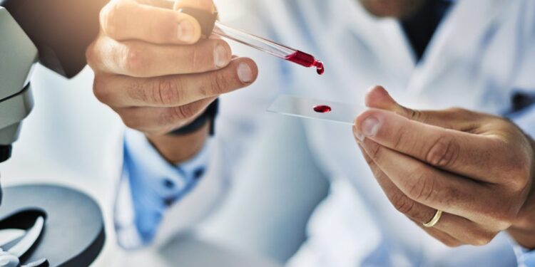 Πρωτοποριακό τεστ αίματος ανιχνεύει τον καρκίνο 3 χρόνια πριν εμφανιστούν τα συμπτώματα